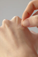 SOME BY MI CLEAR SPOT PATCH-18 PATCHES - Image 3